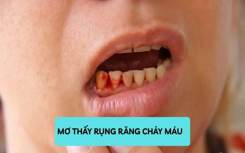 giai dap mo thay rung rang la diem bao tot hay xau